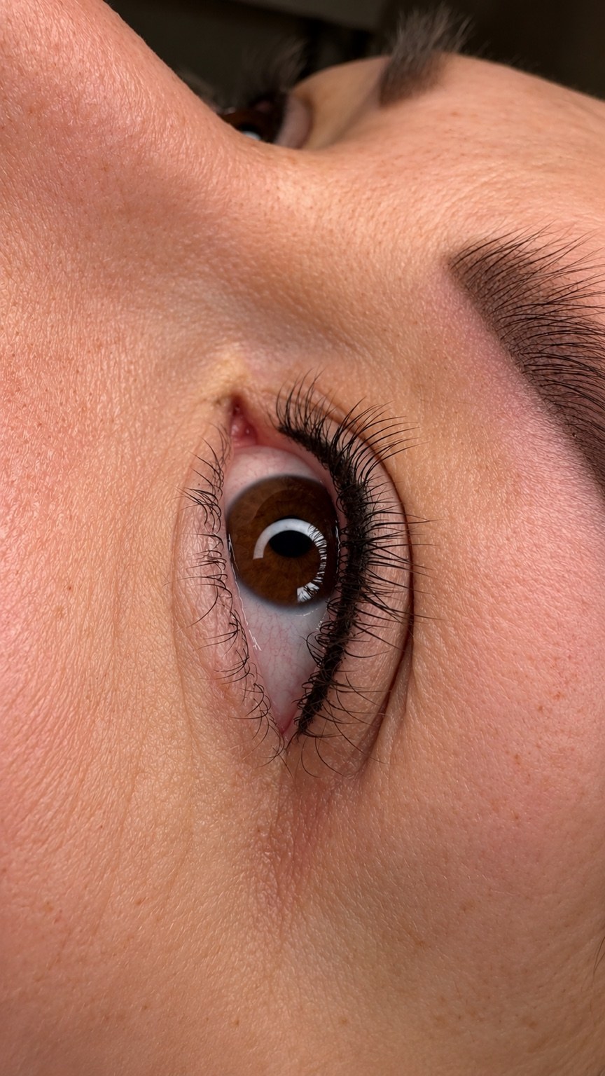 Frische Wimpernkranzverdichtung direkt nach der Behandlung